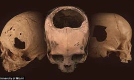 Phát hiện mới ở Peru tiết lộ khả năng phẫu thuật sọ của người Inca
