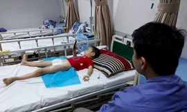 Bệnh nhi điều trị tại Bệnh viện Da liễu Trung ương.