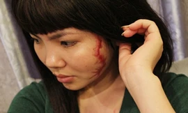 Cô gái bị xăm hình con rết: Xin việc chẳng nơi nào nhận