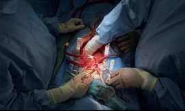 Xin tạm dừng họp Quốc hội để ghép tim cứu người