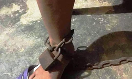 Chị G. bị chồng bạo hành dã man và dọa giết nếu gặp