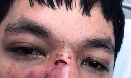 Nạn nhân Nguyễn Văn Lương