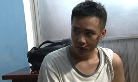 Đối tượng cướp giật Phạm Bá Quang Hiếu với khuôn mặt thương tích, trầy xước do gặp nạn khi thực hiện một phi vụ cướp điện thoại người đi đường tại Huế.