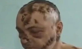 Ma túy 'ăn thịt người' bắt đầu nuốt thanh niên Mỹ