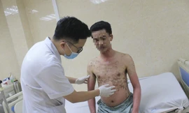 BS thăm khám cho bệnh nhân mắc dị ứng thuốc cực nặng. Ảnh: BS cung cấp