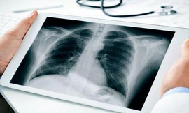 Cứu thiếu nữ Bắc Giang mắc bệnh 'hiểm', 19 tuổi chỉ nặng 18 kg