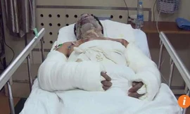 Yu "đánh bom" phòng ngủ để tự tử nhưng lại không chết 