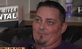 Anh Donny Grigby hiện không còn chiếc răng nào.