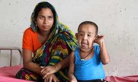 Cậu bé 4 tuổi có ngoại hình như ông lão 80