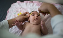 Virus zika gây dị tật đầu nhỏ bẩm sinh đang hoành hành ở châu Mỹ Latinh