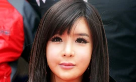 Choáng với gương mặt sưng vù của thành viên nhóm 2NE1