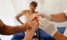 Cá Piranha cắn thịt 70 người