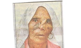 Phát hiện hơn 100 con giòi trong mũi bệnh nhân