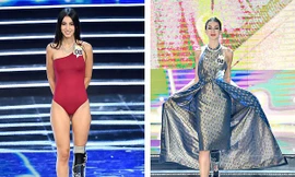 Nghị lực đáng khâm phục của cô gái khuyết tật giành Á hậu Ý