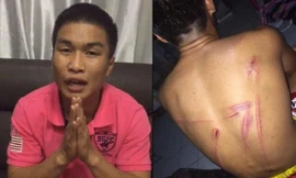 Bức ảnh Nattawut tung lên mạng làm bằng chứng tố cáo bị HLV đánh đập