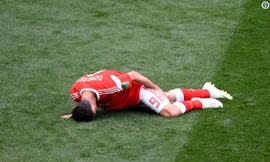  Alan Dzagoev dính chấn thương sau vài 22 phút thi đấu ở trận khai mạc