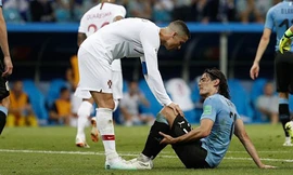 Tin nhanh World Cup: Uruguay nhận tin dữ trước đại chiến với Pháp