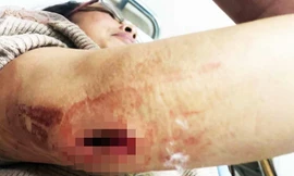 Nạn nhân bị thương, phải vào bệnh viện cấp cứu