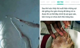 Xử phạt người đàn bà tung tin đồn thất thiệt thịt lợn nhiễm sán trên Facebook