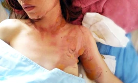 Nạn nhân bị bỏng nặng