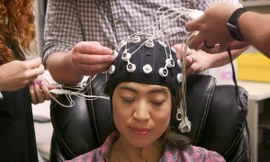 Nghiên cứu kích điện não được quân đội Mỹ tài trợ. Ảnh: NPR.