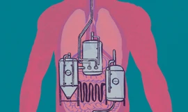 Hội chứng tự sinh rượu – các vi khuẩn trong ruột chuyển hóa carbohydrate thành rượu. Tranh: October. 