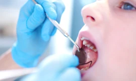 Nên đi khám răng miệng thường xuyên, có răng sâu là phải chữa ngay. Ảnh: Raising Children Network.