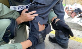 Một cảnh sát Hong Kong bị tên bắn vào chân. Ảnh: AP.