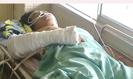 Bị bắn hơn 80 viên đạn chì vẫn sống