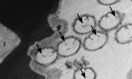 Mẫu tinh trùng hóa thạch có niên đại 17 triệu năm. Ảnh: DM 