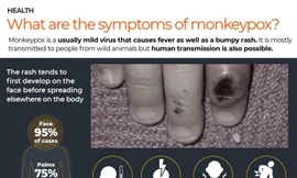 Phòng chống bệnh đậu mùa khỉ: Việt Nam đề nghị WHO, Nhật, Mỹ hỗ trợ 