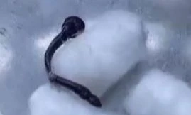 Phát hiện đỉa dài 6cm sống ký sinh trong mũi một phụ nữ