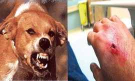 Người đàn ông ở Quảng Ngãi tử vong sau 2 tháng nghi bị chó dại cắn