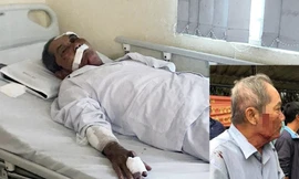 Cụ ông 80 tuổi nhập viện sau khi bị hành hung.