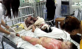 Cháu Trần Thị Huyền (4 tuổi) khi đang điều trị tại Bệnh viện Việt Tiệp (Hải Phòng). Ảnh: Lam Khê