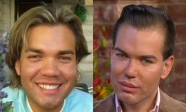 Khuôn mặt anh Rodrigo trước và sau thẩm mĩ.