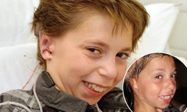 Ghép tai làm từ sụn người cho cậu bé 9 tuổi