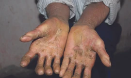 Gia tộc 'giời đày'