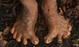 Bộ tộc có bàn chân 6 ngón, sống biệt lập với thế giới