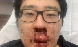 Ông Peng Wang sau khi bị tấn công. (Ảnh: FB)