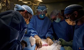 Ca ghép thận của lợn cho người được thực hiện tại một bệnh viện ở Mỹ. (Ảnh: Reuters)