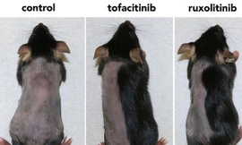 Sắp có thuốc trị hói?