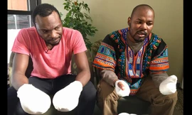 Hai người tị nạn Ghana bị bỏng lạnh, phải cắt bỏ ngón tay. Ảnh: CNN