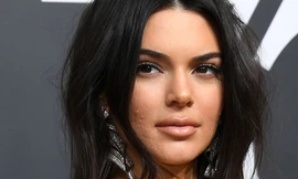 Kendall Jenner với khuôn mặt mụn tạo nên cả một trend “không thèm che khuyết điểm”.