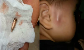 Vĩnh Phúc: Đang xác minh các vụ đạn “rơi” vào dân