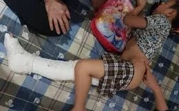 Cháu Trần Chí Kiên vẫn đang phải nghỉ học, nằm nhà do tai nạn gãy chân trong trường học.