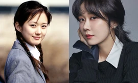 "Khổ" như Jang Na Ra: Hơn 20 năm qua luôn bị "réo tên" vì chi tiết này trên cơ thể