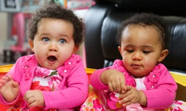 Amelia và Jasmine không giống nhau như các cặp song sinh cùng trứng thông thường.