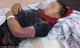 Người phụ nữ trẻ tiều tụy trong bệnh viện.