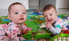 Hai bé Charlotte và Olivia Hill.